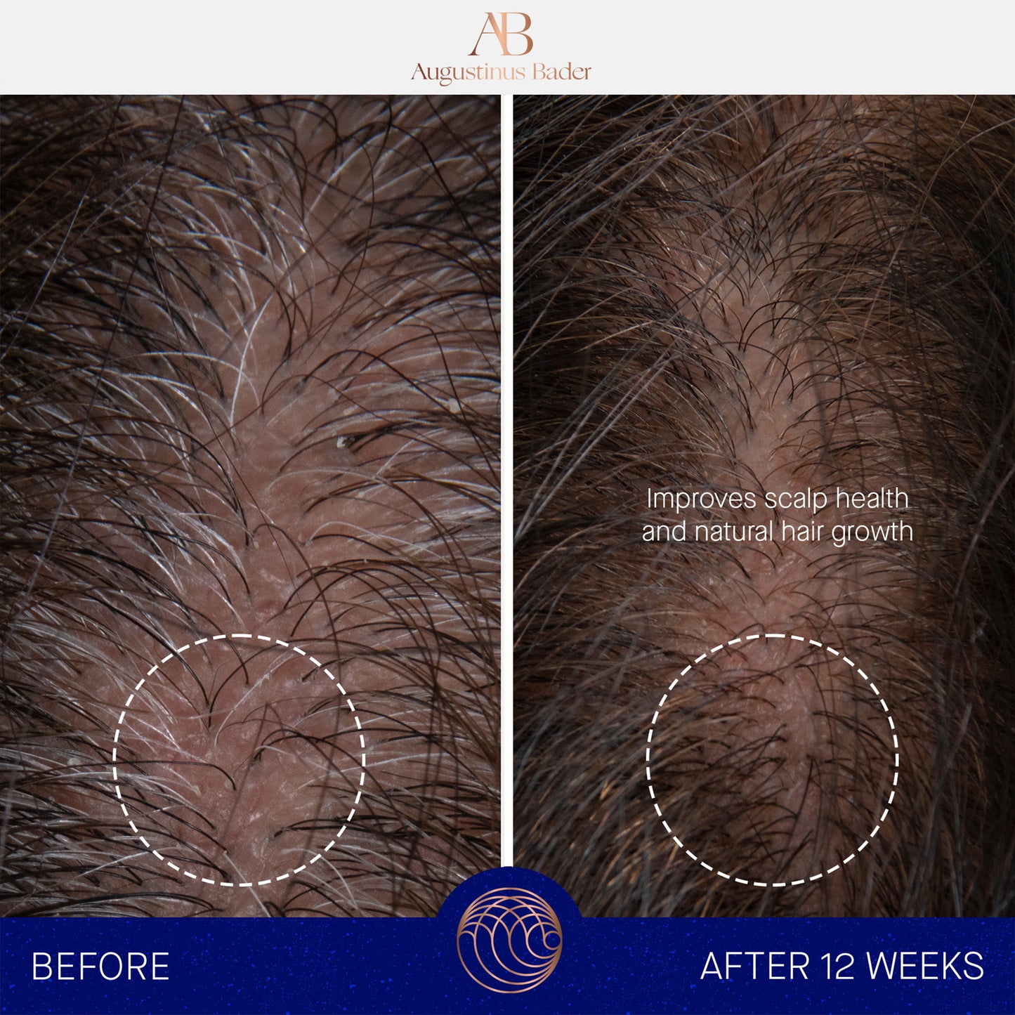 Augustinus Bader The Scalp Treatment