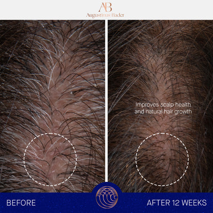 Augustinus Bader The Scalp Treatment