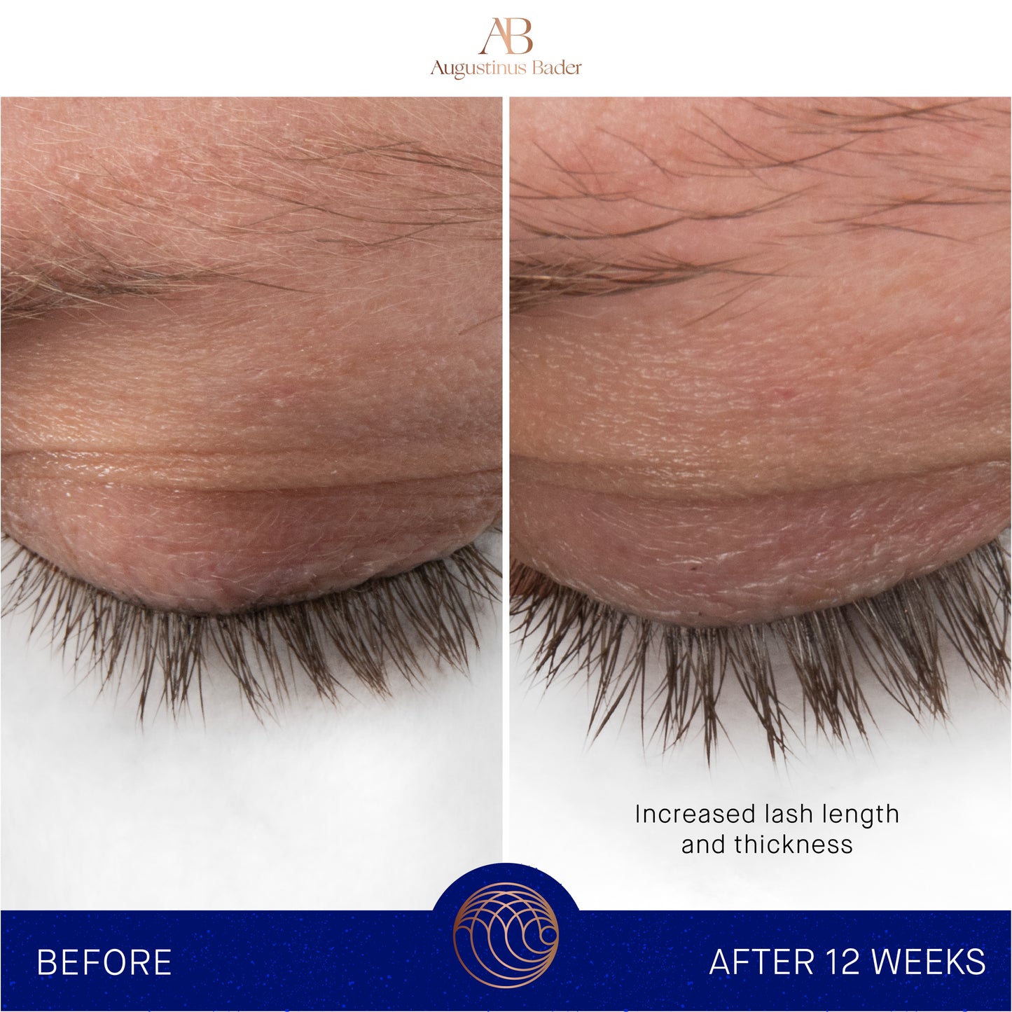 Augustinus Bader The Eyebrow & Lash Enhancing Serum
