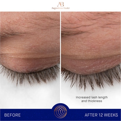 Augustinus Bader The Eyebrow & Lash Enhancing Serum
