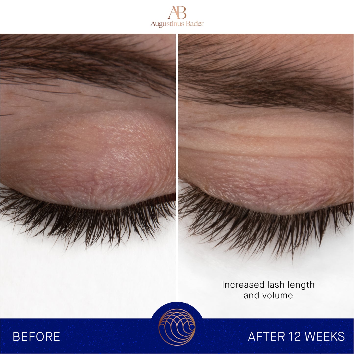 Augustinus Bader The Eyebrow & Lash Enhancing Serum