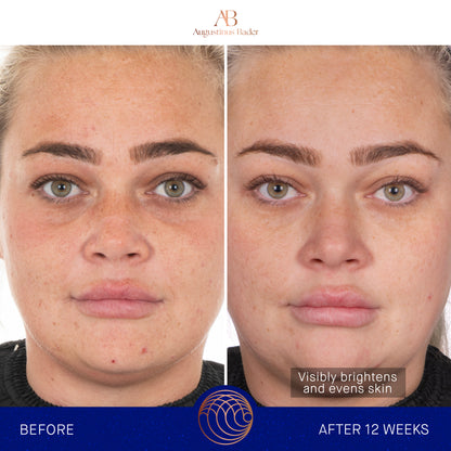 Augustinus Bader The Face Cream Mask