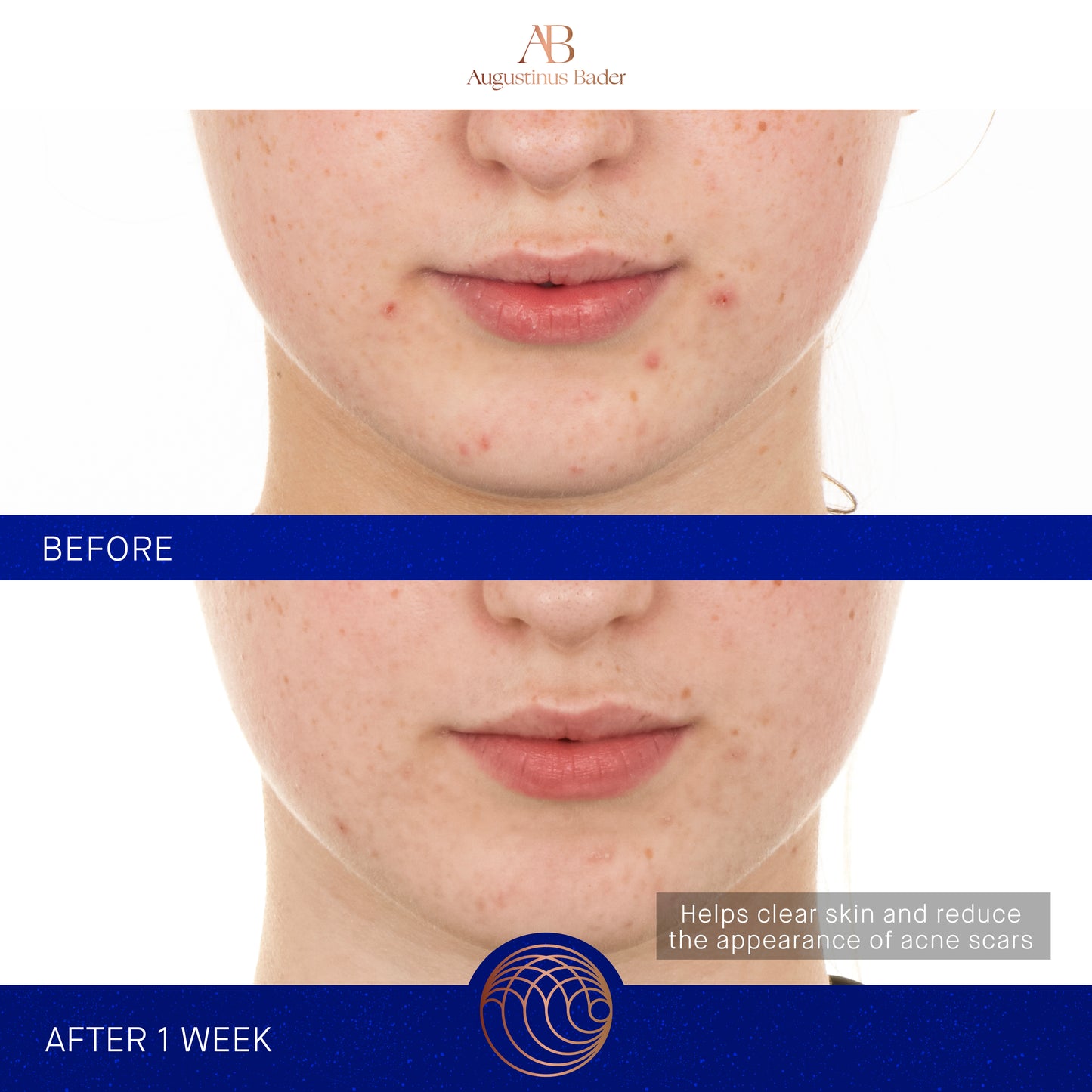 Augustinus Bader The Retinol Serum