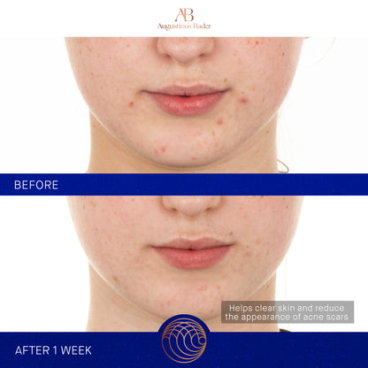 Augustinus Bader The Retinol Serum