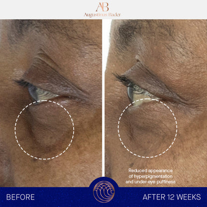 Augustinus Bader The Eye Cream
