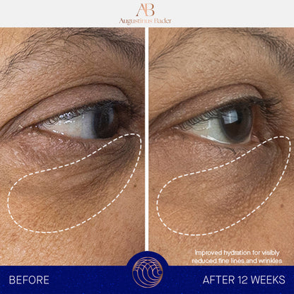 Augustinus Bader The Eye Cream