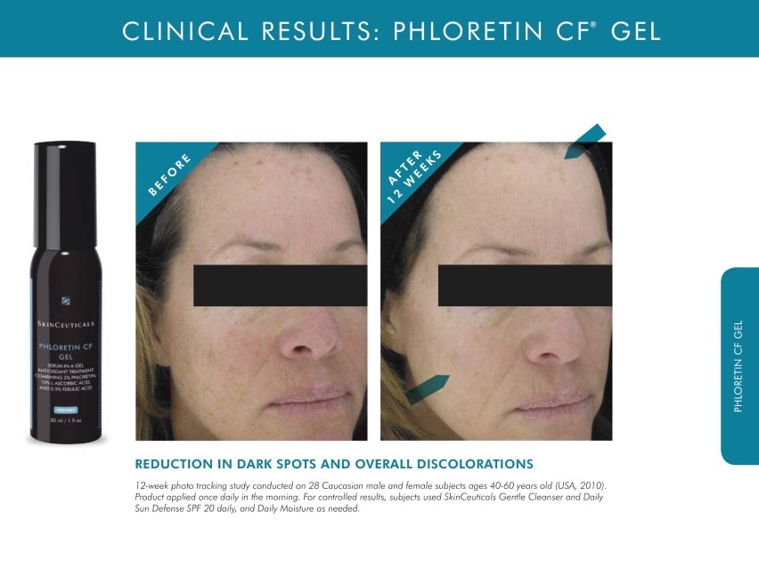 SkinCeuticals Phloretin CF Gel