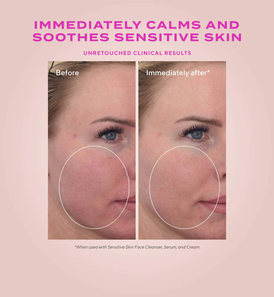 Murad Heartleaf Calming Cream Moisturizer for Sensitive Skin and Eczema-Prone Skin
