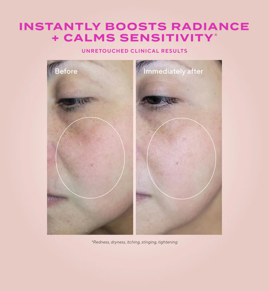 Murad Gentle Glycolic Acid Resurfacing Serum for Sensitive Skin