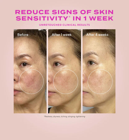 Murad Gentle Glycolic Acid Resurfacing Serum for Sensitive Skin
