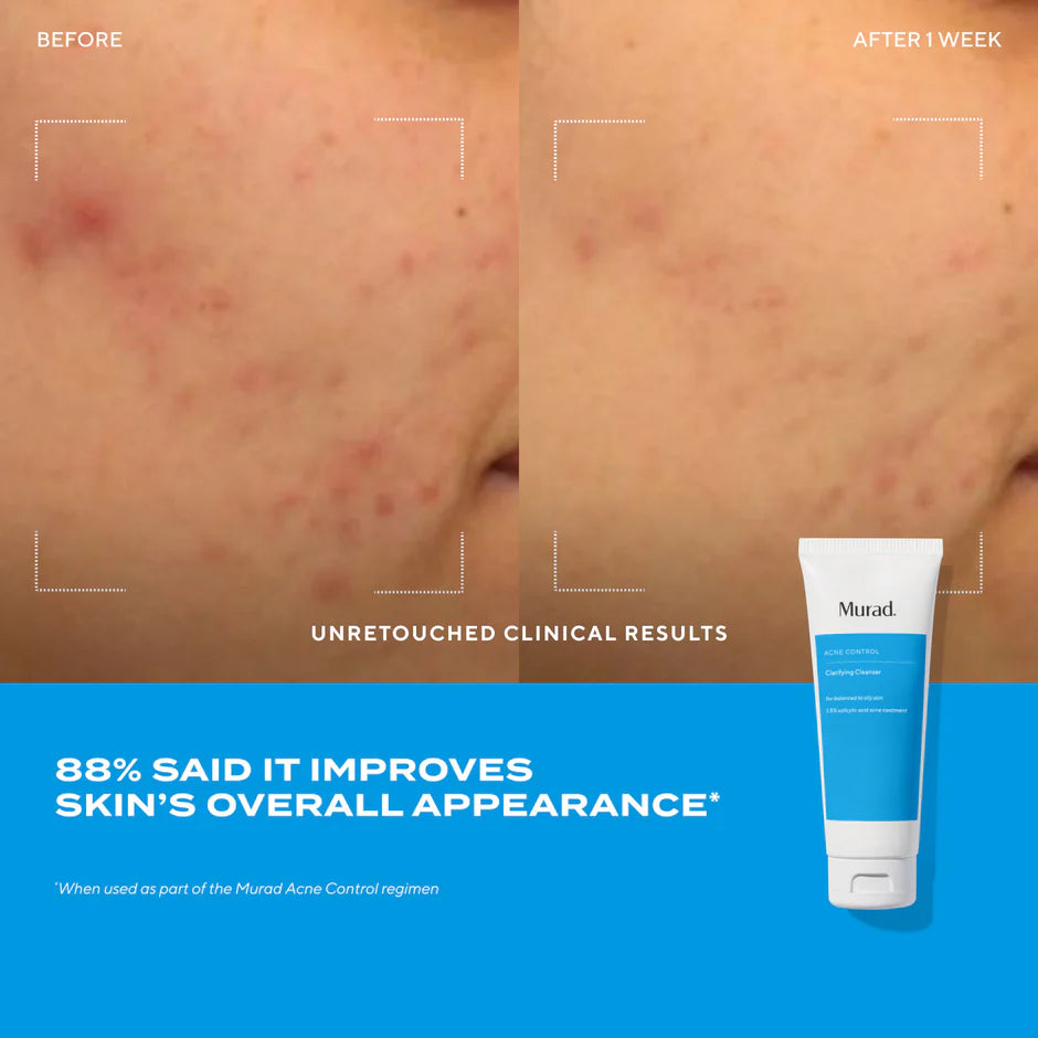 Murad Acne Control Clarifying Cleanser