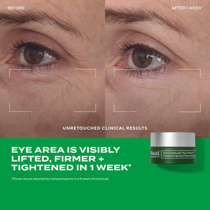 Murad Retinal ReSculpt Eye Lift Treatment