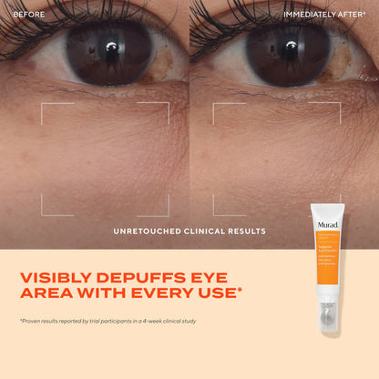 Murad Targeted Eye Depuffer
