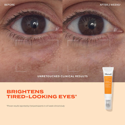 Murad Targeted Eye Depuffer
