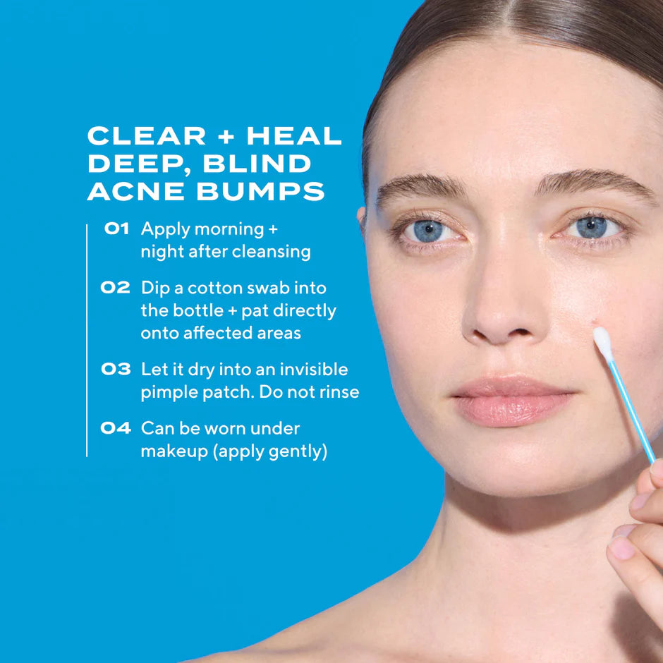 Murad Deep Relief Acne Treatment