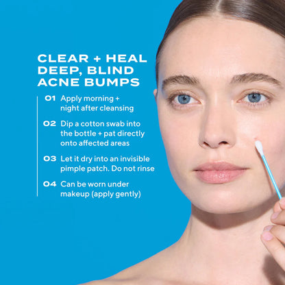 Murad Deep Relief Acne Treatment