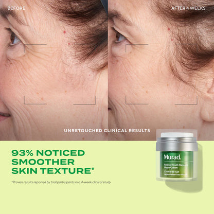 Murad Retinol Youth Renewal Night Cream