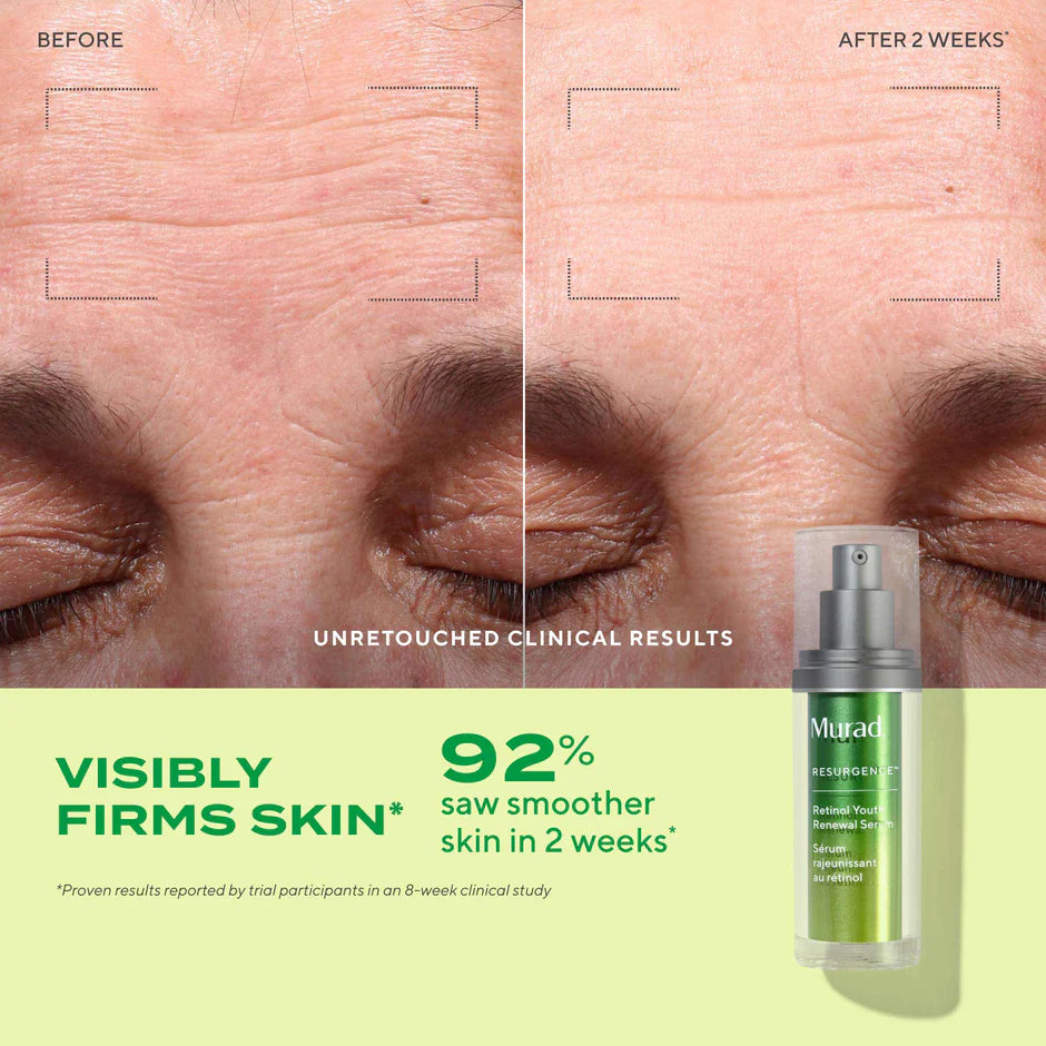 Murad Retinol Youth Renewal Serum