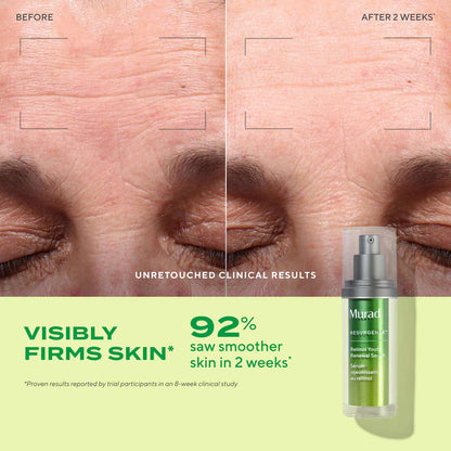 Murad Retinol Youth Renewal Serum