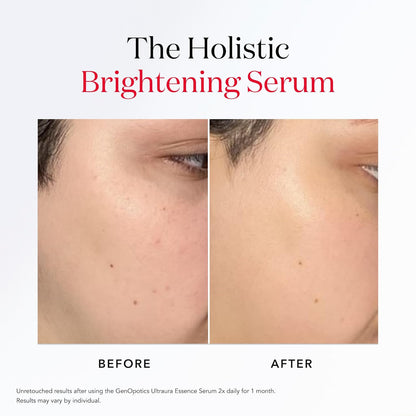 SK-II GenOptics Ultraura Essence