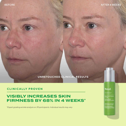 Murad Retinol Youth Renewal Face Oil Drops