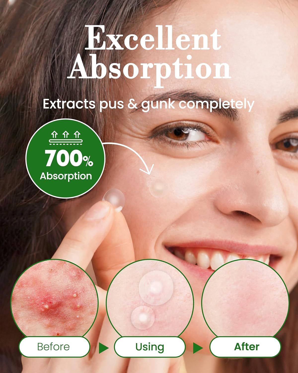 Troubless Invisible Pimple Spot Patch - The Signature