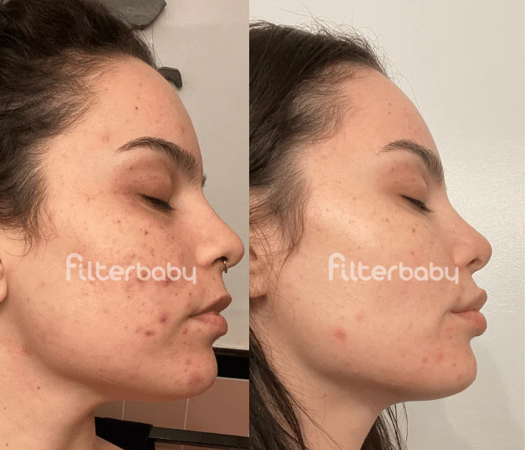 Filterbaby Skincare Filter Replacement 2.0