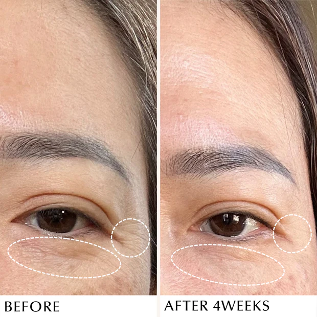 ALBION INFINESSE Derma Impact Cream