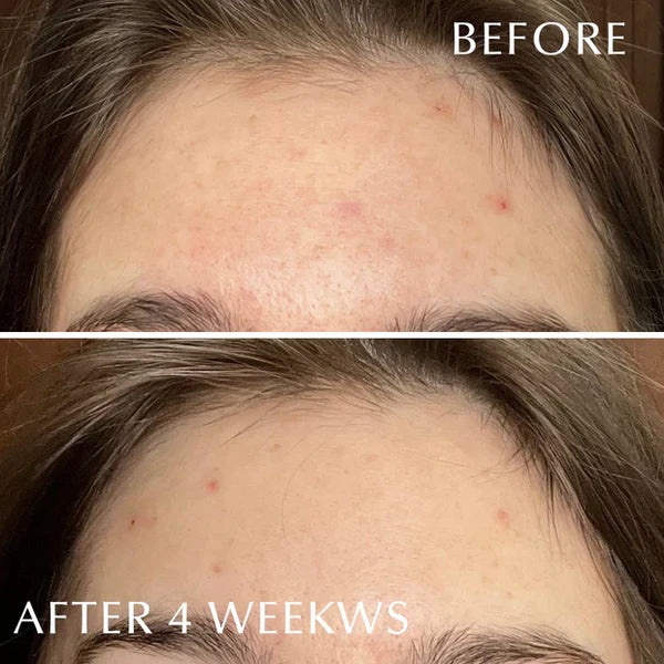 ALBION Skin Conditioner Essential N