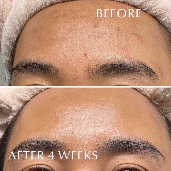 ALBION Skin Conditioner Essential N