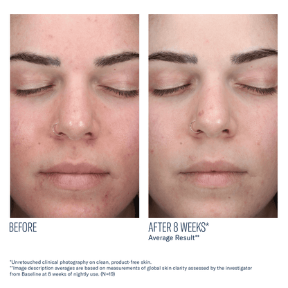 skinbetter AlphaRet Clearing Serum