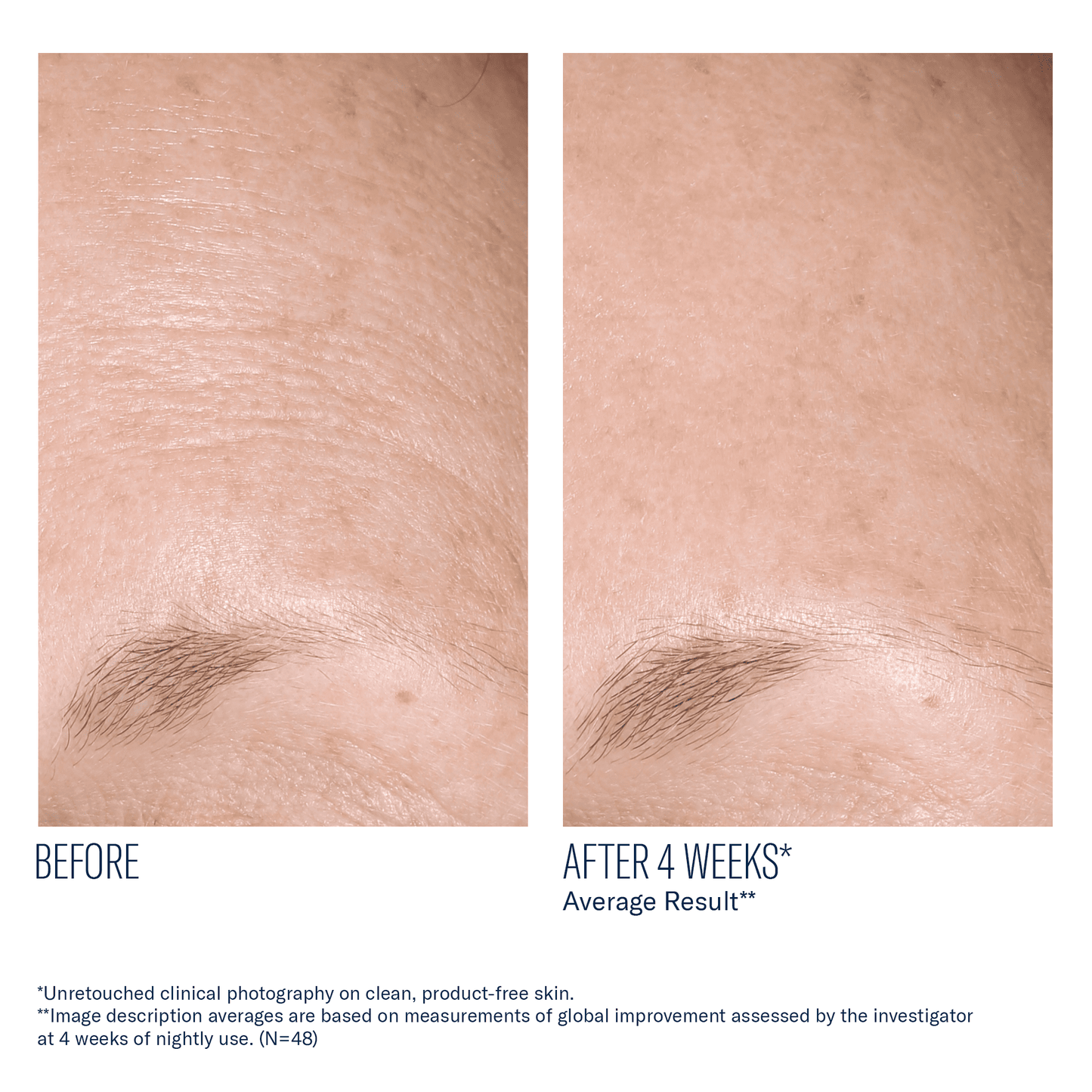skinbetter AlphaRet Overnight Cream