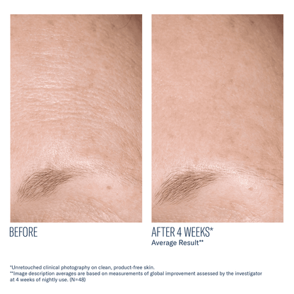 skinbetter AlphaRet Overnight Cream