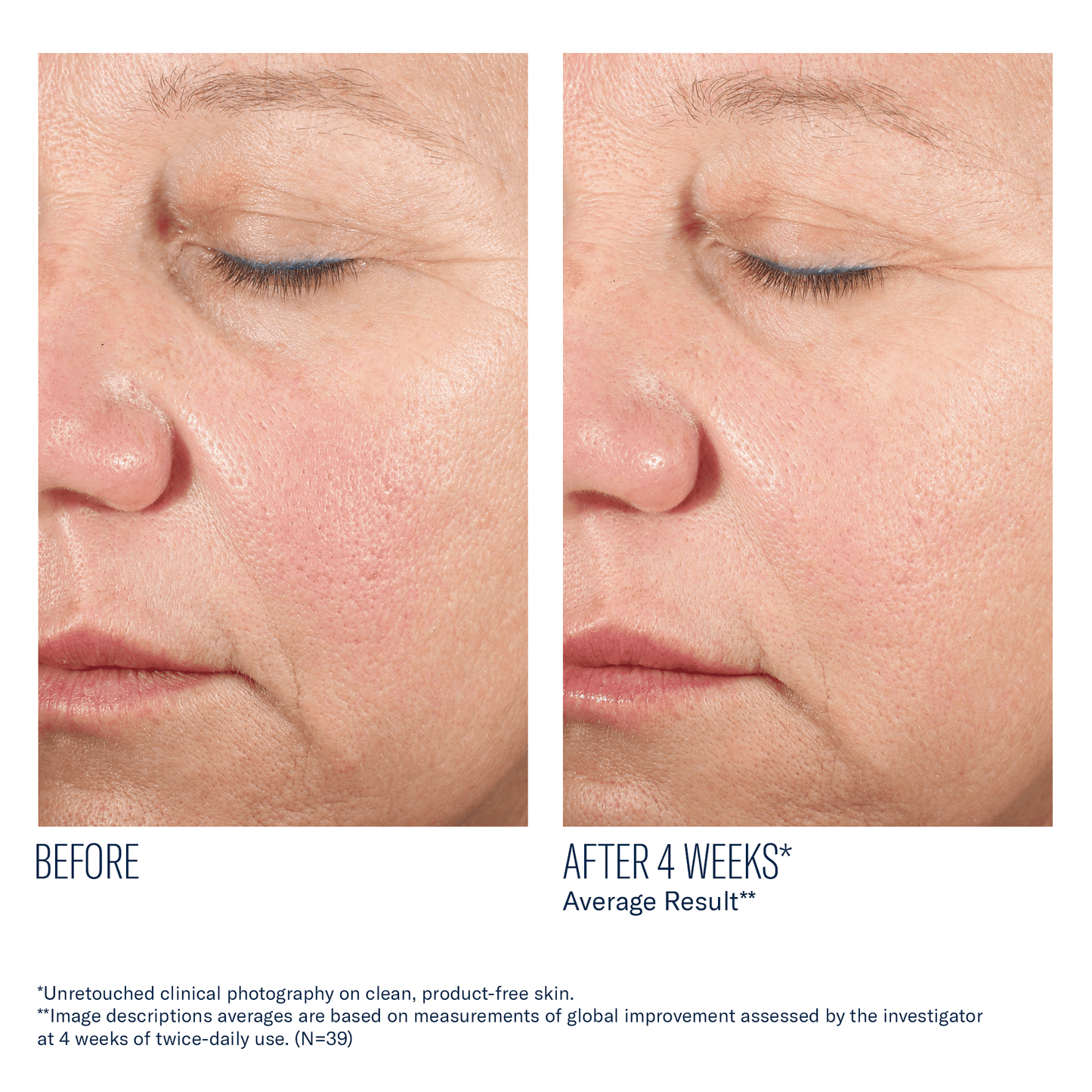 skinbetter Alto Advanced Defense And Repair Serum