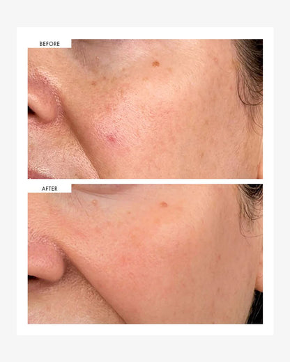 111SKIN Dark Spot Correcting Serum 30 mL