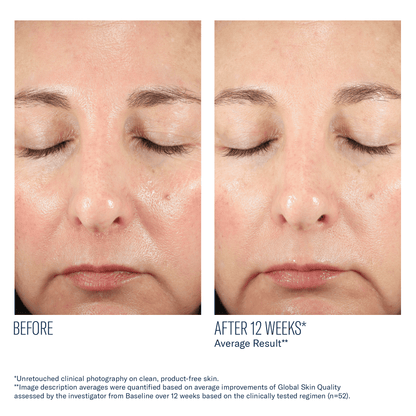 skinbetter BioRewind Skin Health Dietary Supplement