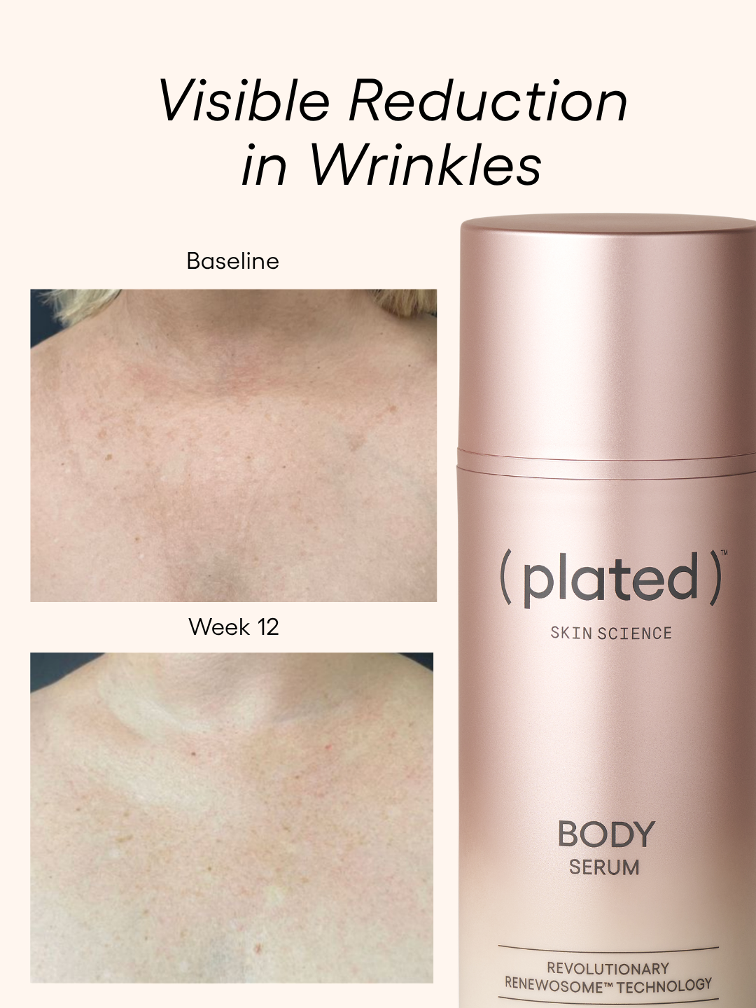 ( plated ) Skin Science BODY Serum