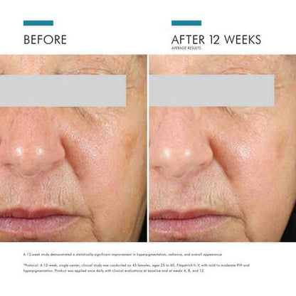 SkinCeuticals Daily Brightening UV Defense SPF 30
