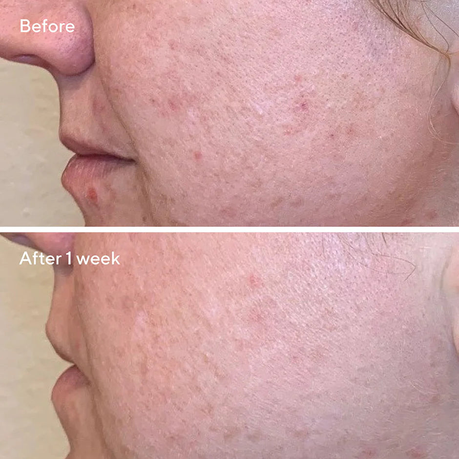 Murad Daily Clarifying Peel