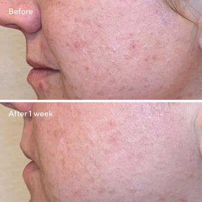 Murad Daily Clarifying Peel
