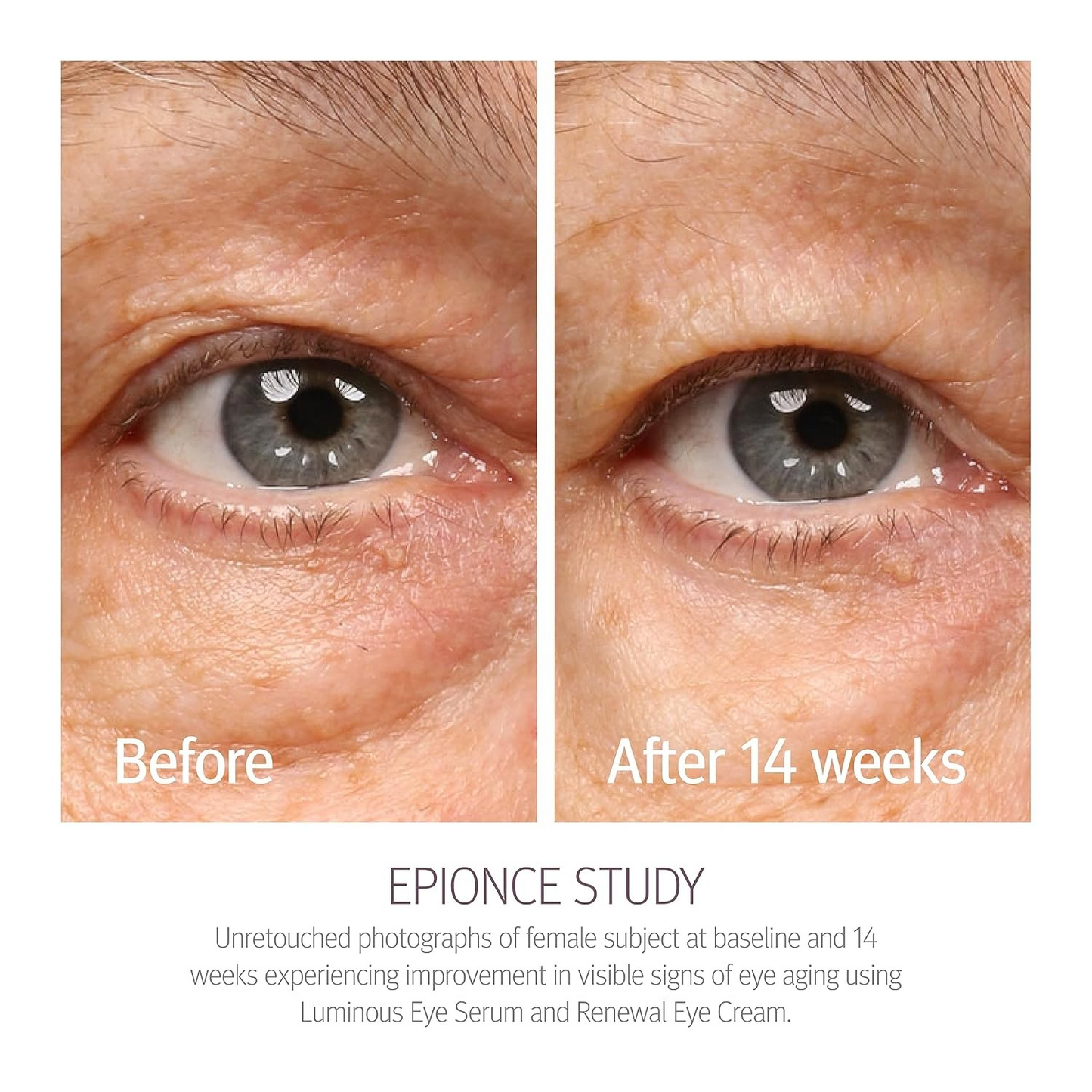 Epionce Renewal Eye Cream