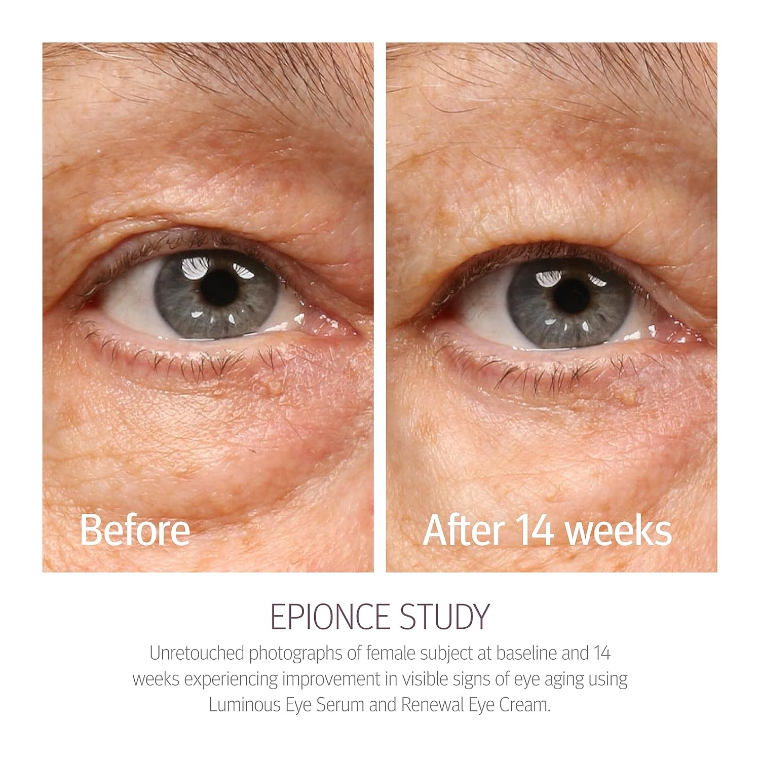 Epionce Renewal Eye Cream