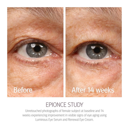 Epionce Renewal Eye Cream