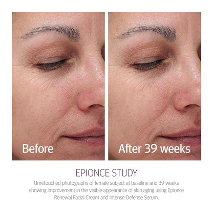 Epionce Renewal Facial Cream