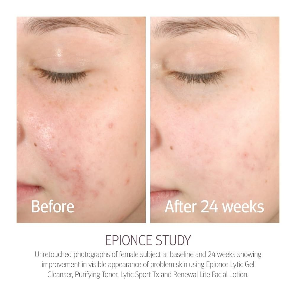Epionce Renewal Lite Facial Lotion