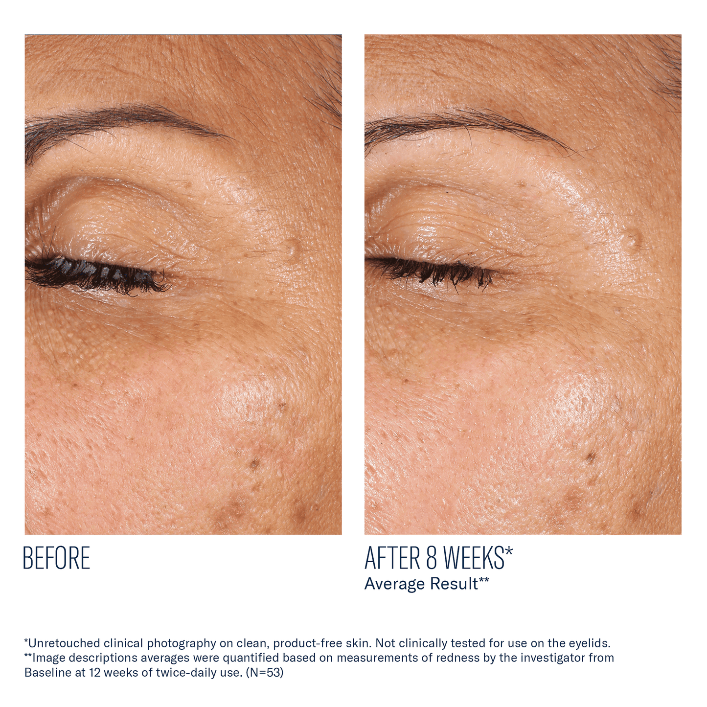 skinbetter EyeMax AlphaRet Overnight Cream