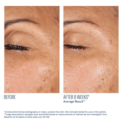 skinbetter EyeMax AlphaRet Overnight Cream