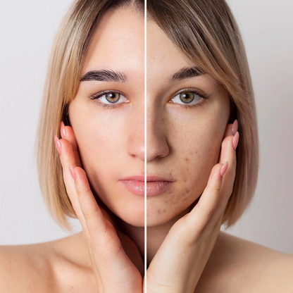 HONEY ZIP Agave Moisture Fit Mask