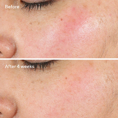 Murad Intense Recovery Cream