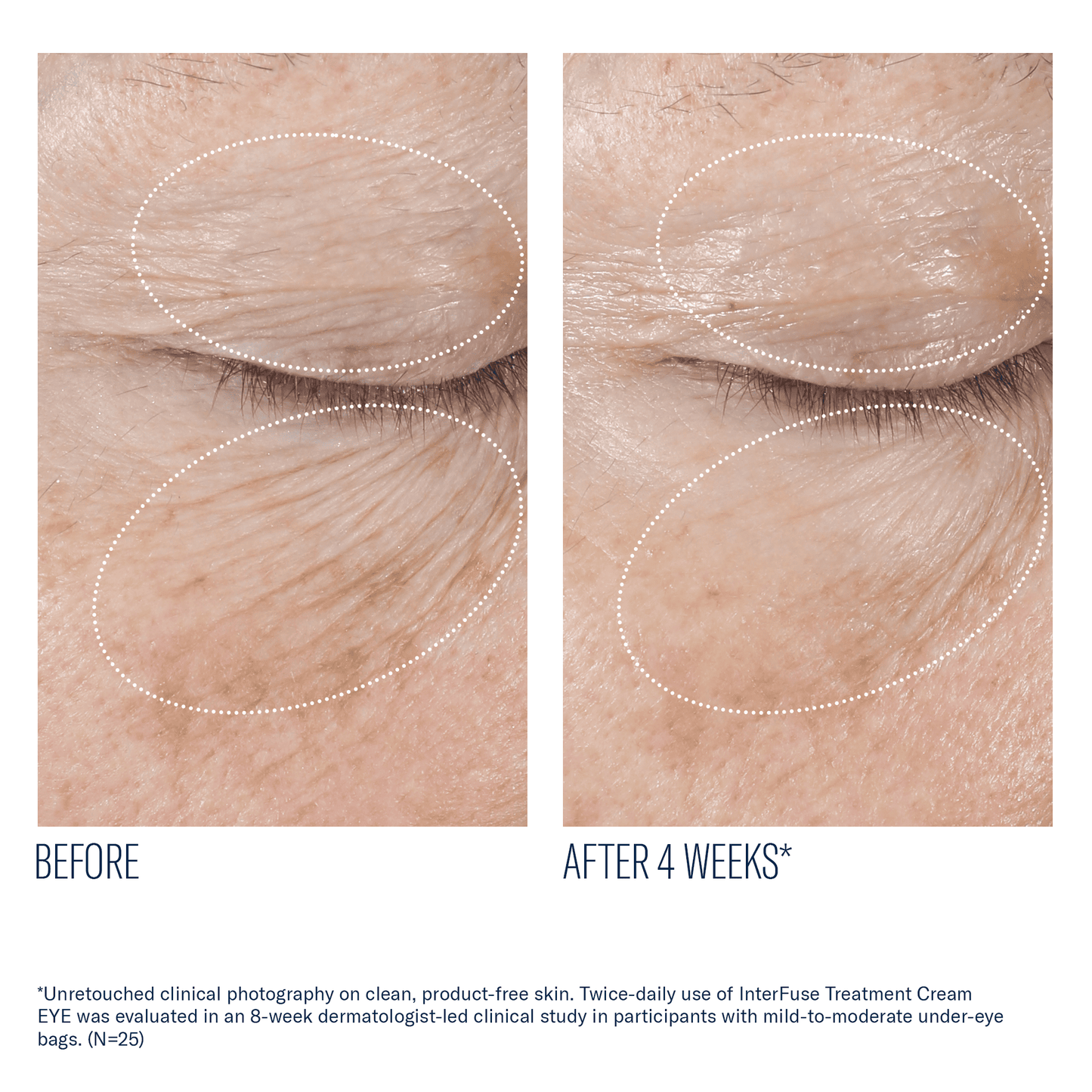 skinbetter InterFuse Treatment Cream EYE
